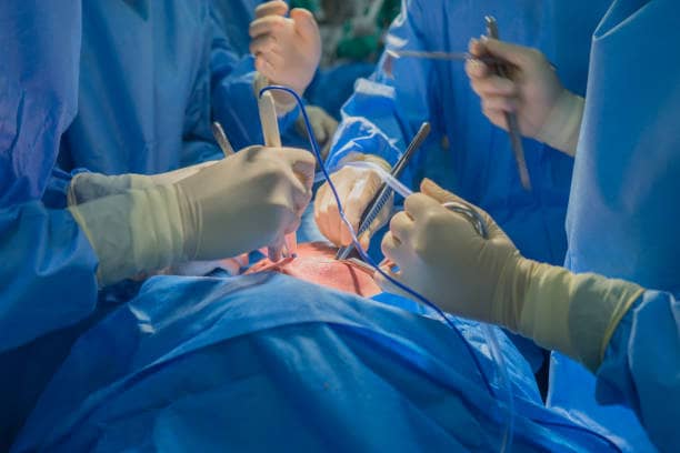 What Should You Know About Open-Heart Surgery?